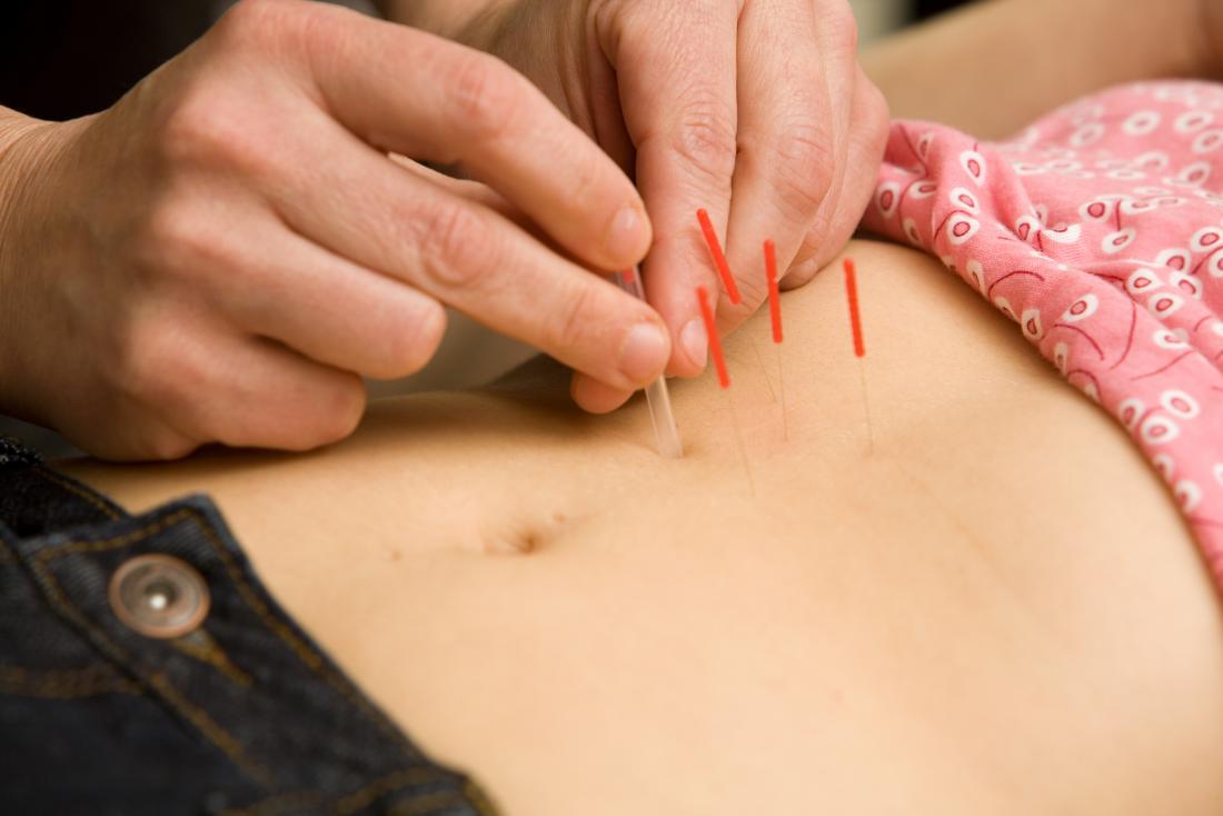 Florida Fertility Acupuncture Acupuncture for Women’s Health & Fertility Support in Boca Raton Women’s health is deeply connected to hormonal balance, stress levels, and overall well-being.