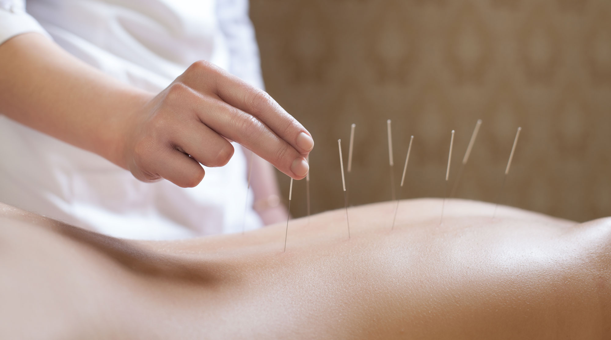 South Florida Acupuncture